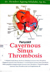 PENYAKIT CAVERNOUS SINUS THROMBOSIS