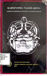 KARSINOMA NASOFARING