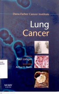 LUNG CANCER