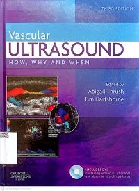 VASCULAR ULTRASOUND