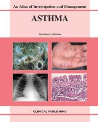 Asthma: An Atlas of Investigation and Diagnosis