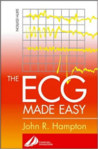 Image of THE ECG MADE EASY