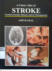 A COLOUR ATLAS OF STROKE CEREBROVASCULAR DISEASE AND ITS MANAGEMENT