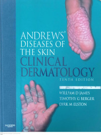 ANDREW'S DISEASES OF THE SKIN CLINICAL DERMATOLOGY.