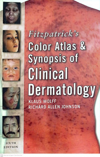 FITZPATRICK'S COLOR ATLAS & SYNOPSIS OF CLINICAL DERMATOLOGY