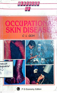 HANDBOOK OF OCCUPATIONAL SKIN DISEASE
