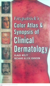FITZPATRICK'S COLOR ATLAS & SYNOPSIS OF CLINICAL DERMATOLOGY
